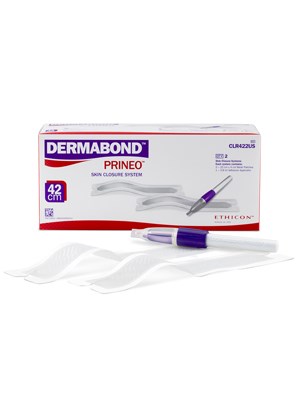 DERMABOND PRINEO Violet Skin Closure System 42cm